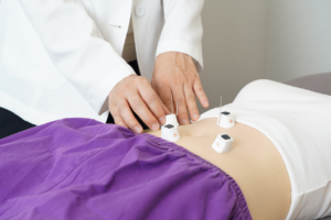 発毛クリニックでの治療方法の違いとは？