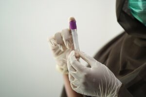 AGA治療で血液検査は毎回いるのか？