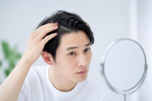 AGA治療の継続割を引き継ぐための条件は何ですか？
