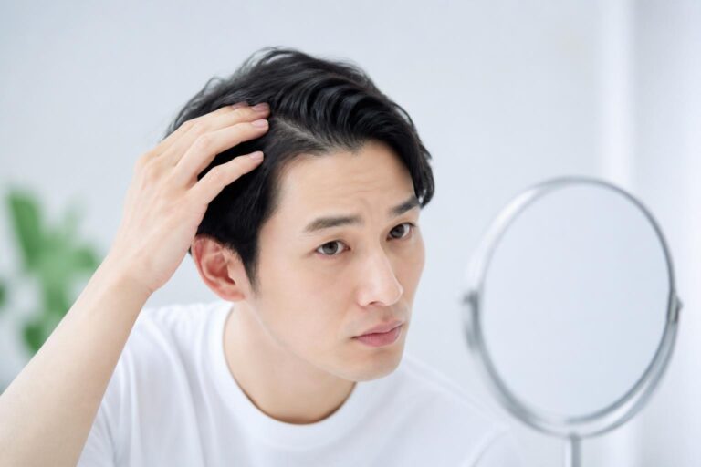 AGA治療の継続割を引き継ぐための条件は何ですか？