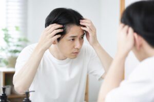 AGA治療の効果を見極める方法は？